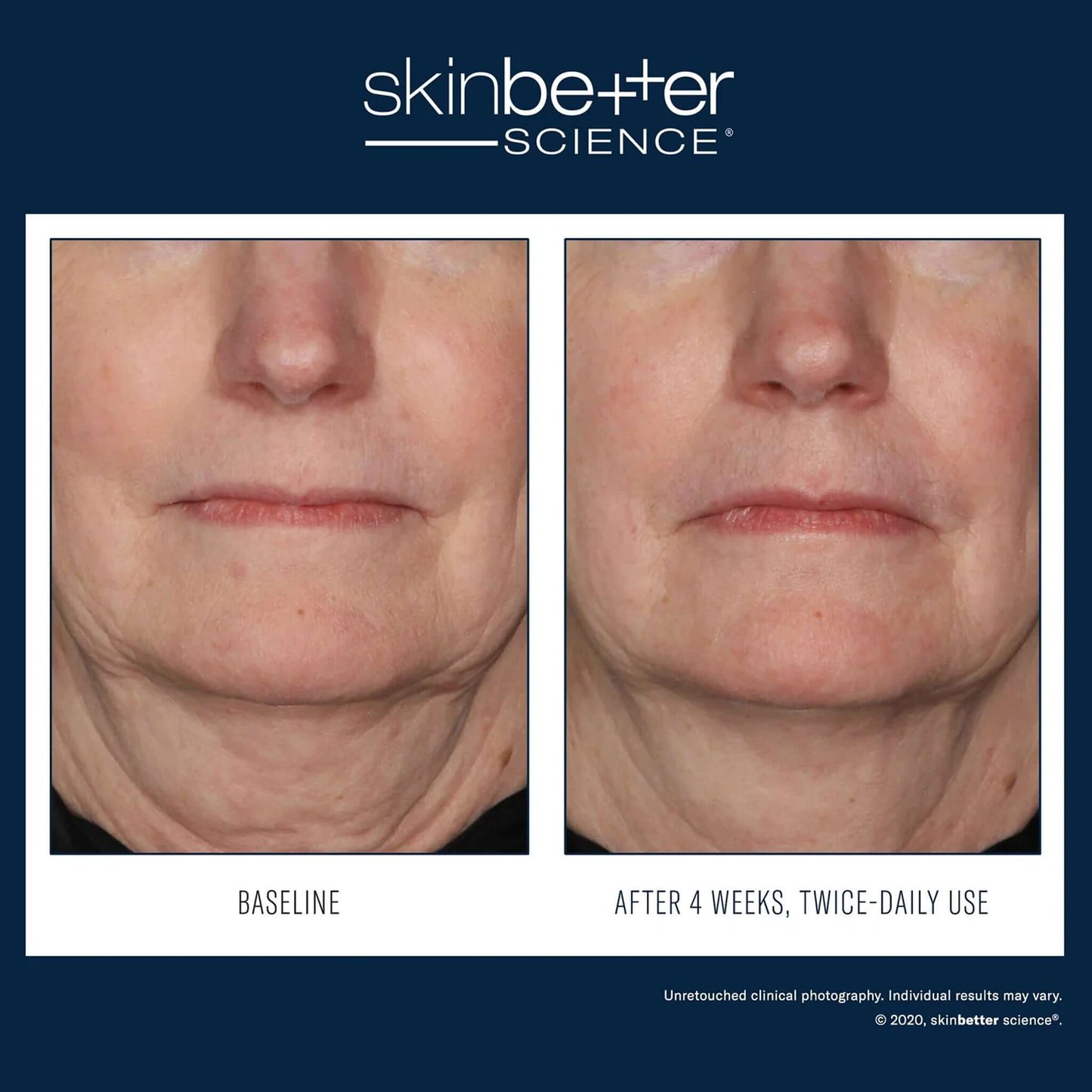 Interfuse treatment cream before and after results on face