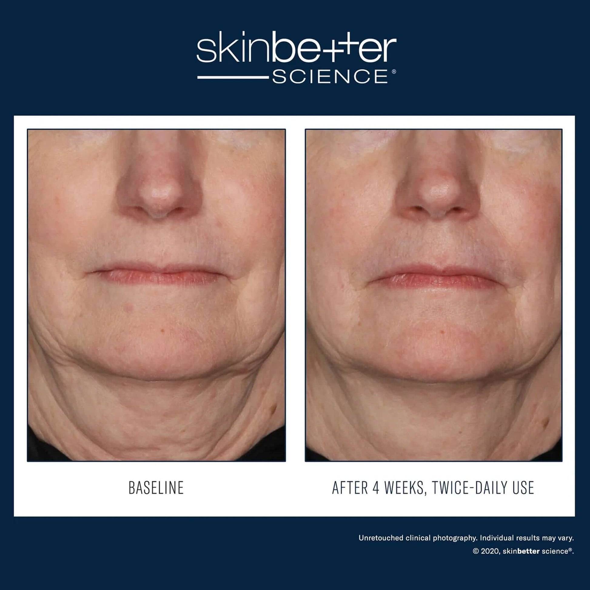 Interfuse treatment cream before and after results on face
